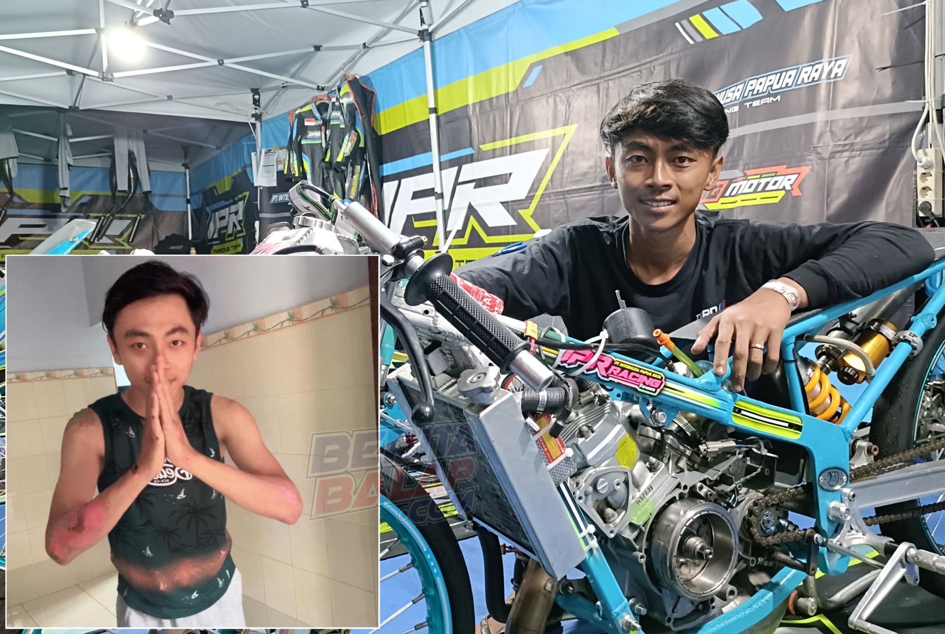 Kondisi Membaik Arya Supe Siap Fight di Seri-4 IDW Jogja, Targetnya Juara