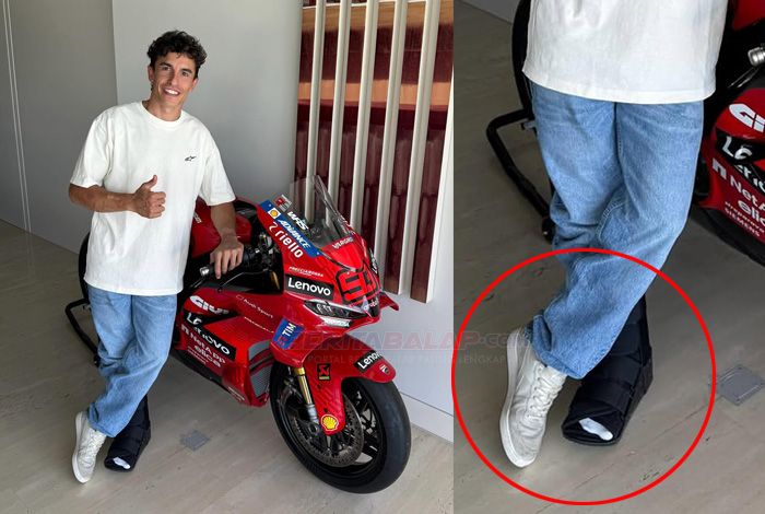 Marc Marquez Siap Kembali Balapan di MotoGP Mugello 2026 Usai Operasi
